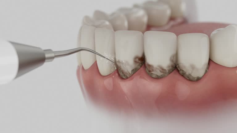 Reliable Dental Implants contractor in Solomon, KS by Smile Center Dentistry